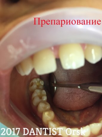 Описание изображения